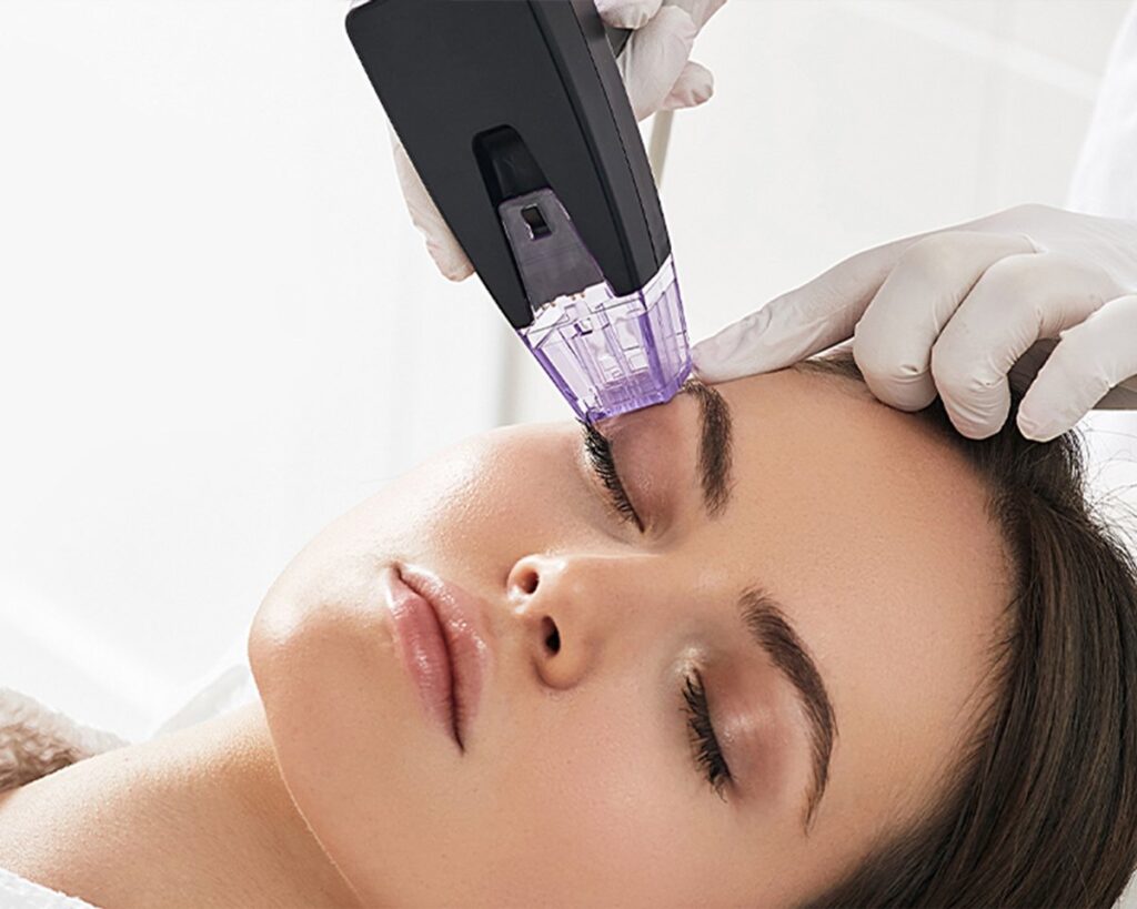 Morpheus8 treatment Los Angeles