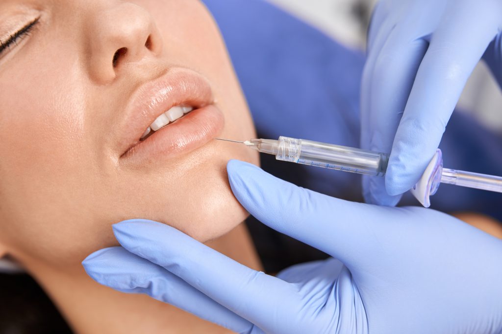 Lip filler injection procedure performed by licensed professional in Los Angeles