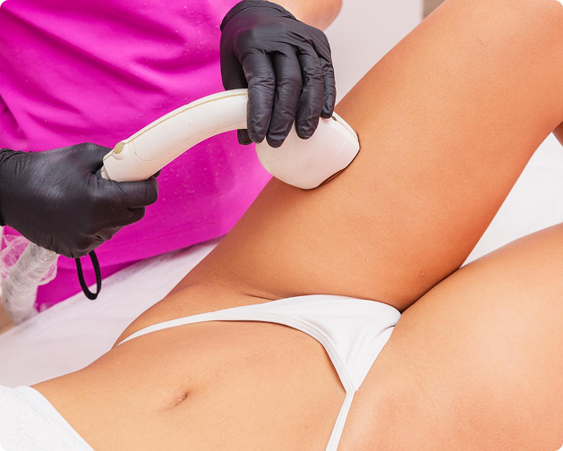 What Is Full Bikini Laser Hair Removal and How Does It Work?​
