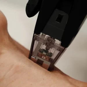 Get-Smooth-Tight-and-Flawless-Skin-with-Morpheus8-The-Latest-in-Skin-Resurfacing-Technology