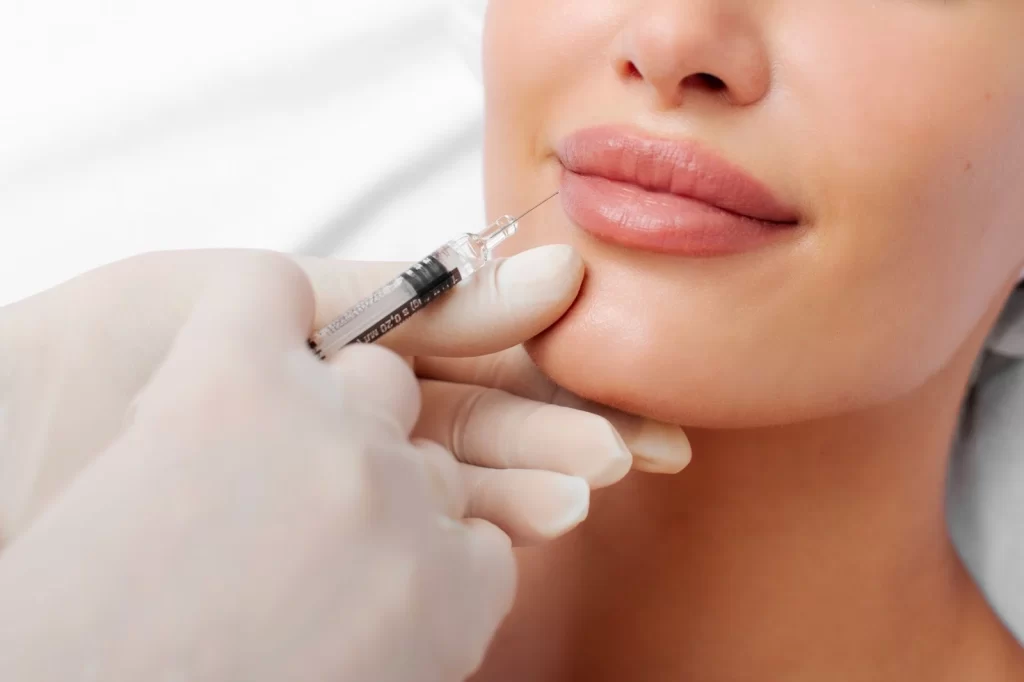 Lip Fillers in Los Angeles: 10 Things to Know for Natural, Beautiful Results